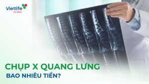 Chụp x quang lưng