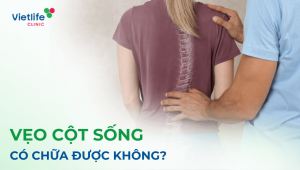 Vẹo cột sống