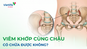 Viêm khớp cùng chậu