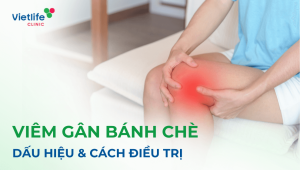 Viêm gân bánh chè