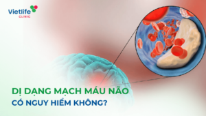 Dị dạng mạch máu não