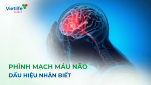 Phình mạch máu não