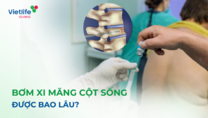 Bơm xi măng cột sống được bao lâu