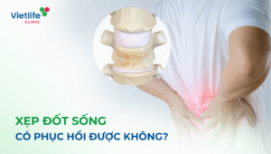 Xẹp đốt sống có phục hồi được không